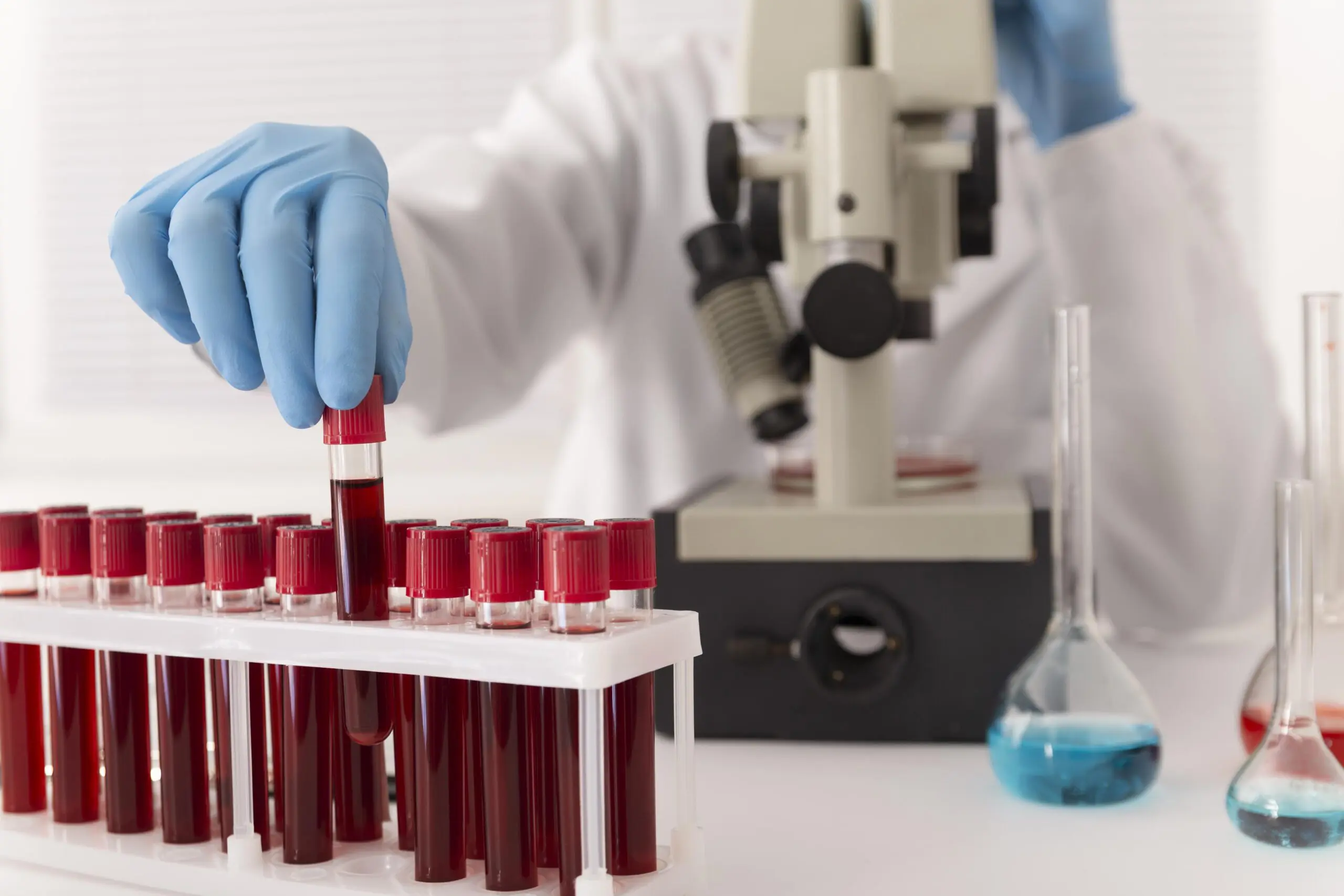 blood-samples-being-studied-in-a-lab