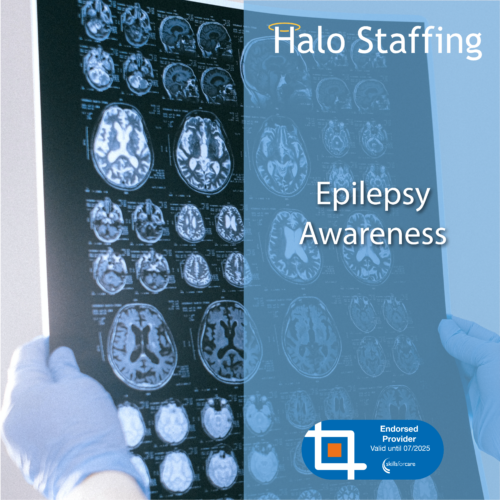 An MRI scan of a brain in detail. Overlaid are the words 'Halo Staffing, Epilepsy Awareness' and underneath is a Skills For Care Endorsed Provider logo
